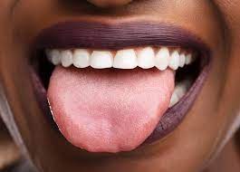 What Does Your Tongue Say About Your Health?